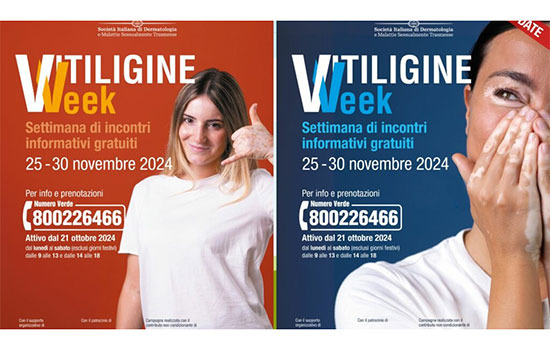 Salute / Milano - 'Vitiligine Week'